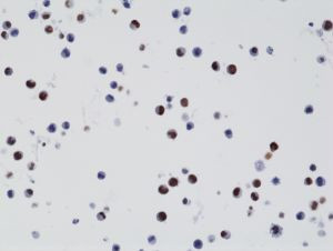 H3.3 K27M oncohistone mutant Antibody in Immunocytochemistry (ICC/IF)