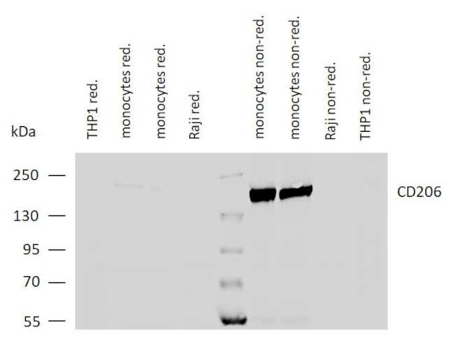 CD206 (MMR) Antibody in Western Blot (WB)