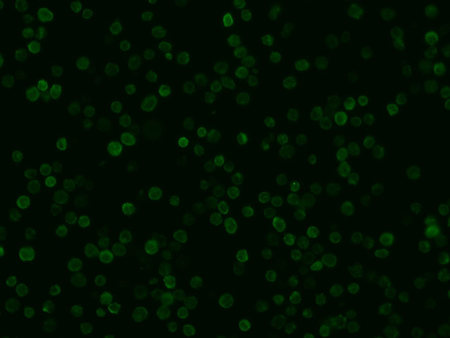 IBA1 Antibody in Immunocytochemistry (ICC/IF)