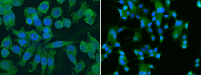 ALDH1A1 Antibody in Immunocytochemistry (ICC/IF)