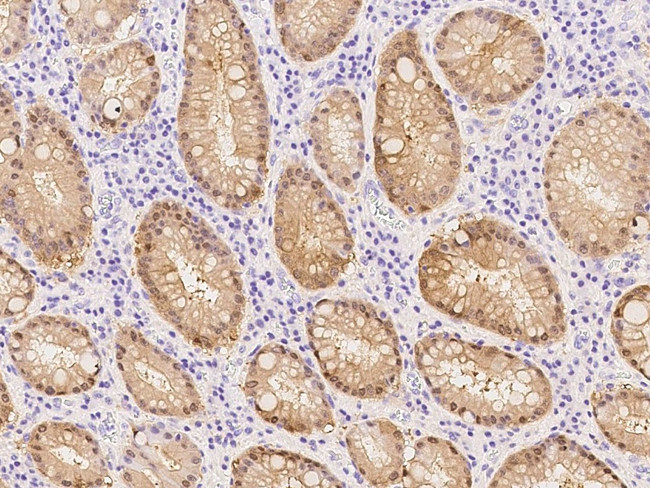 Caspase 14 Antibody in Immunohistochemistry (Paraffin) (IHC (P))