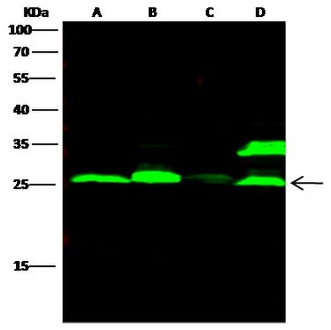 Cathepsin L Antibody in Western Blot (WB)