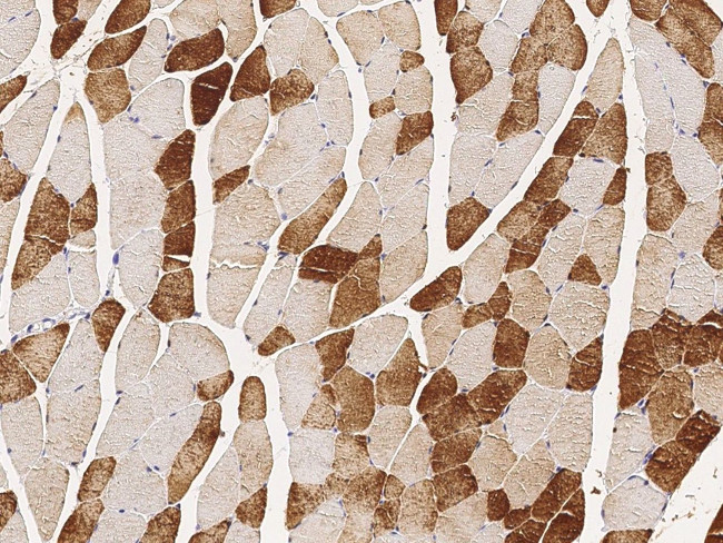 ENO3 Antibody in Immunohistochemistry (Paraffin) (IHC (P))