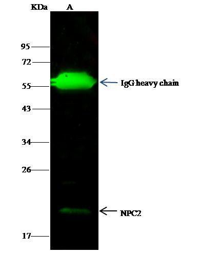 NPC2 Antibody in Immunoprecipitation (IP)