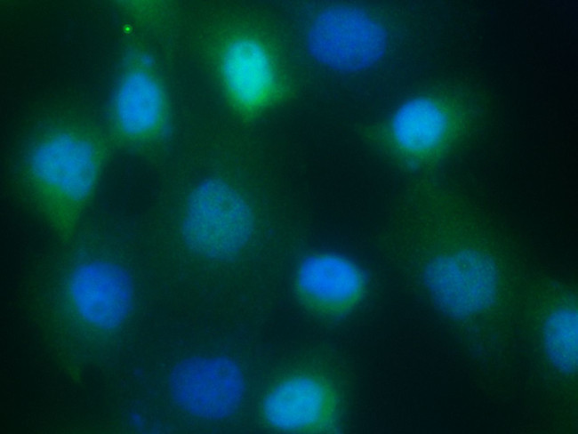 S100A9 Antibody in Immunocytochemistry (ICC/IF)