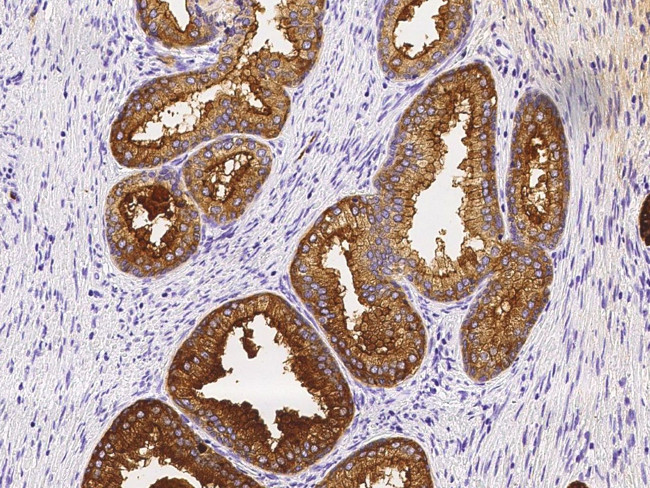 TSPAN1 Antibody in Immunohistochemistry (Paraffin) (IHC (P))