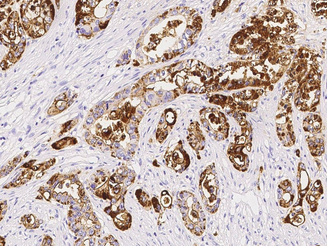 TSPAN1 Antibody in Immunohistochemistry (Paraffin) (IHC (P))