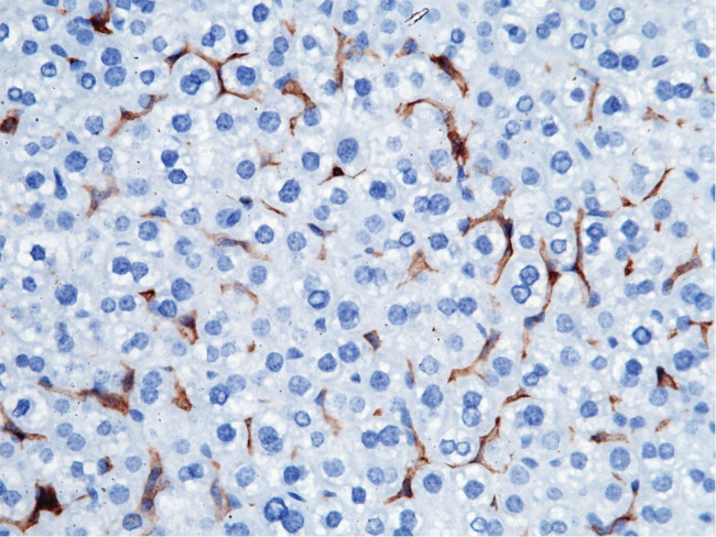 CD16-2 Antibody in Immunohistochemistry (Paraffin) (IHC (P))
