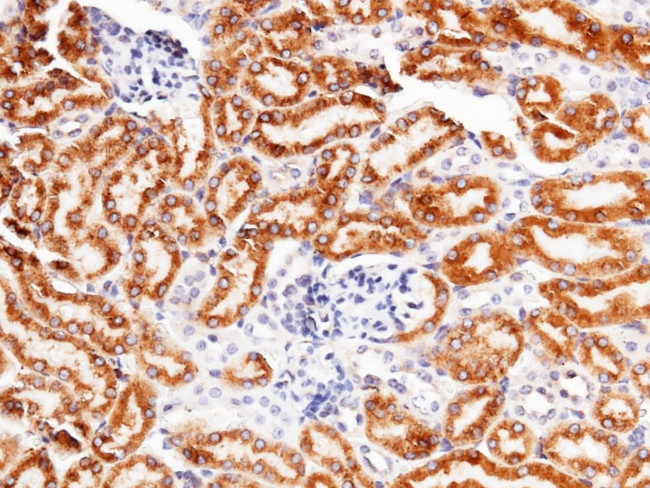 RAP Antibody in Immunohistochemistry (Paraffin) (IHC (P))