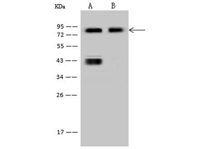 CD44 Antibody in Western Blot (WB)