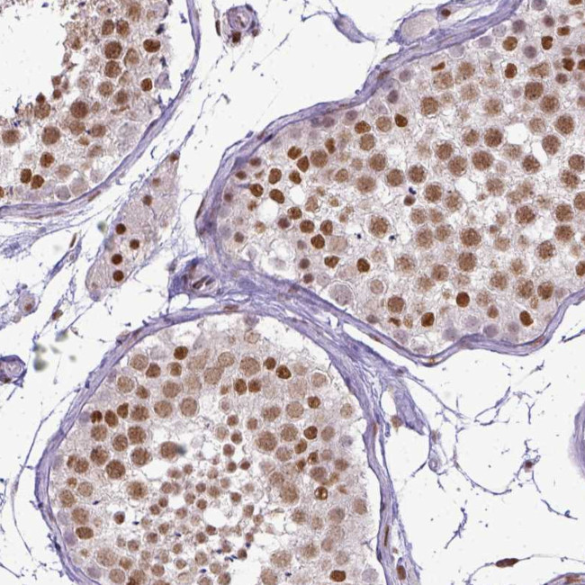 ERCC1 Antibody in Immunohistochemistry (Paraffin) (IHC (P))