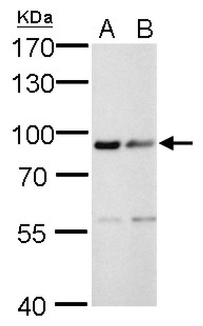 Calnexin Antibody in Western Blot (WB)