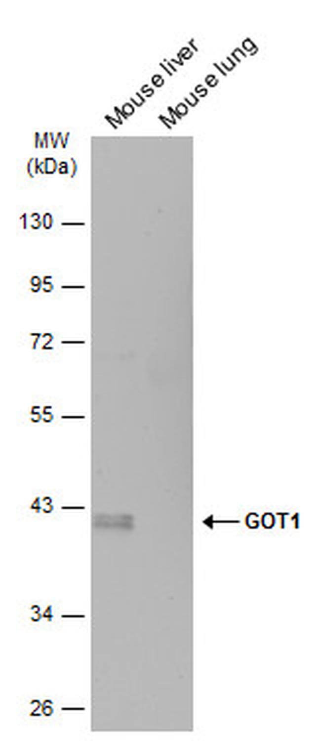 GOT1 Antibody in Western Blot (WB)