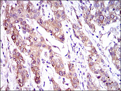 MRP4 Antibody in Immunohistochemistry (Paraffin) (IHC (P))