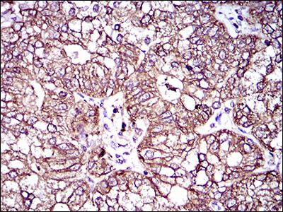 MRP4 Antibody in Immunohistochemistry (Paraffin) (IHC (P))