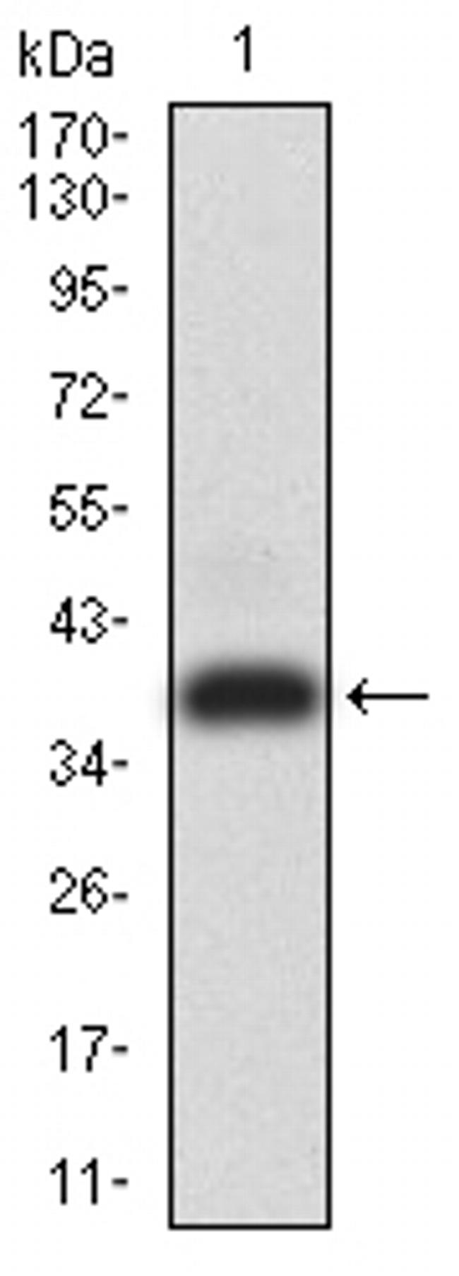 ADAMTS1 Antibody in Western Blot (WB)