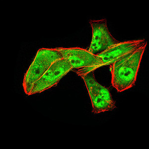 ALDH6A1 Antibody in Immunocytochemistry (ICC/IF)