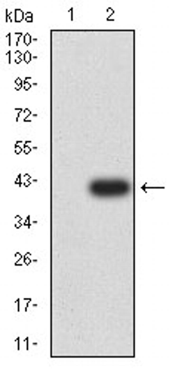 CCR1 Antibody in Western Blot (WB)