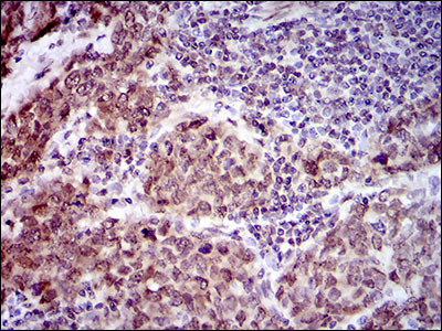 CLGN Antibody in Immunohistochemistry (Paraffin) (IHC (P))