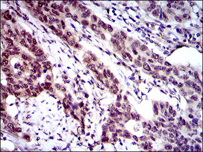 CLGN Antibody in Immunohistochemistry (Paraffin) (IHC (P))