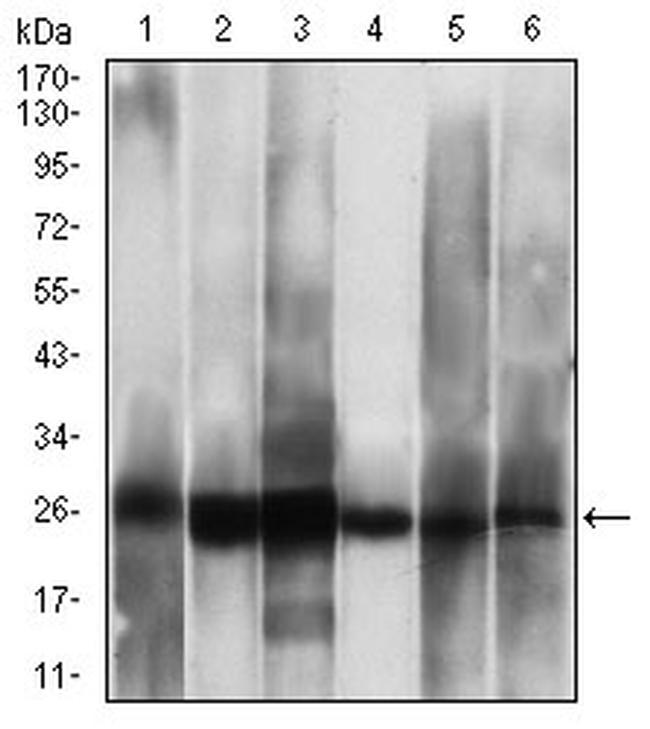 CK2 beta Antibody in Western Blot (WB)