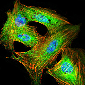 GRIK4 Antibody in Immunocytochemistry (ICC/IF)