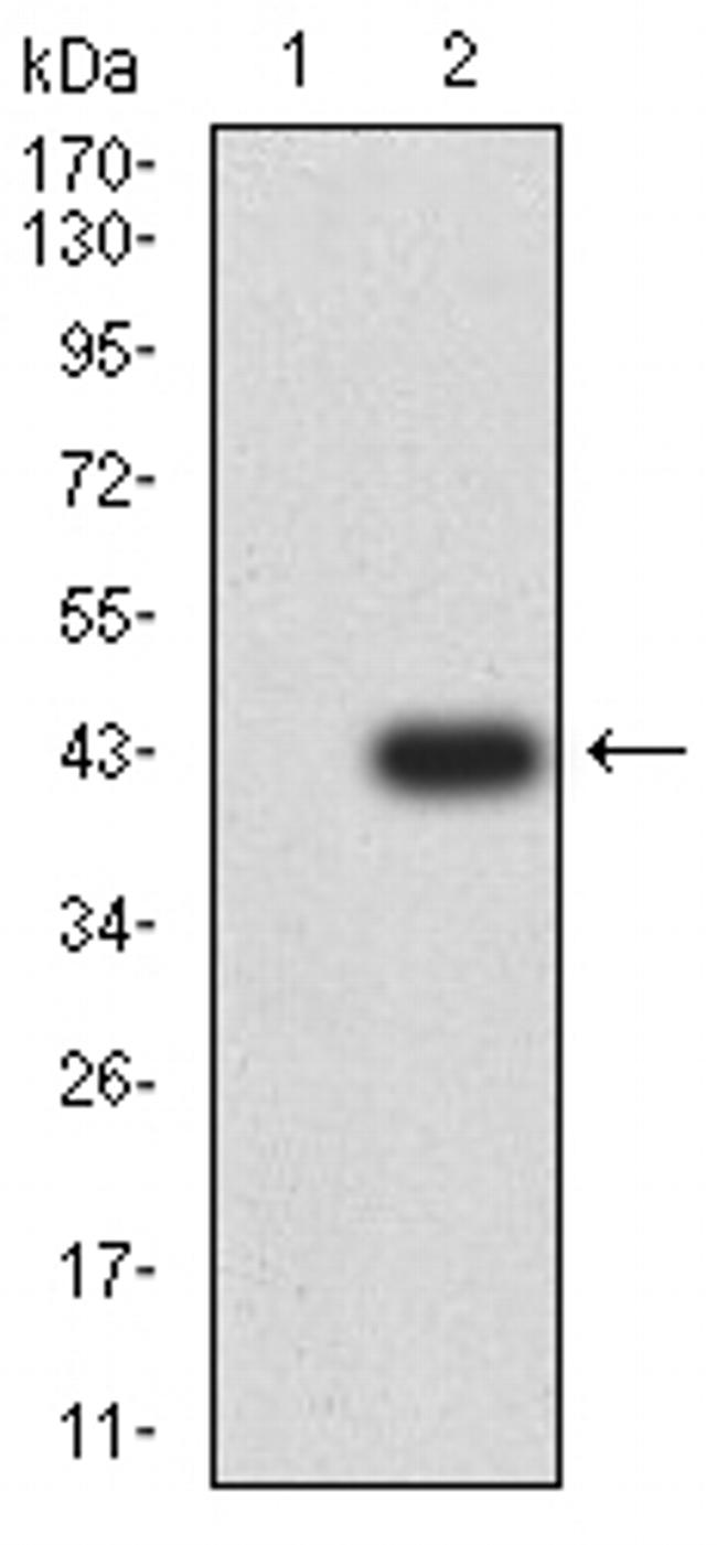 GRIK5 Antibody in Western Blot (WB)