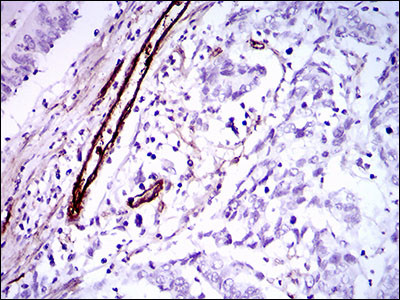 GSC Antibody in Immunohistochemistry (Paraffin) (IHC (P))