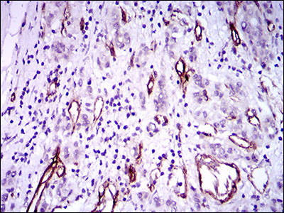 GSC Antibody in Immunohistochemistry (Paraffin) (IHC (P))