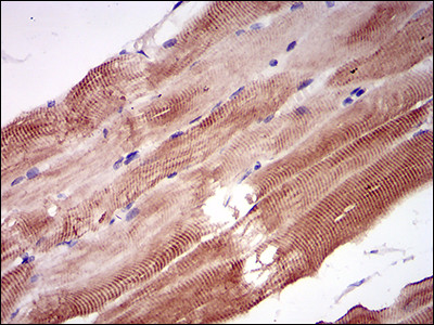 NPC1 Antibody in Immunohistochemistry (Paraffin) (IHC (P))