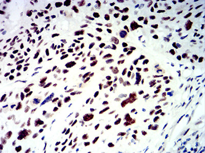 SMARCA1 Antibody in Immunohistochemistry (Paraffin) (IHC (P))