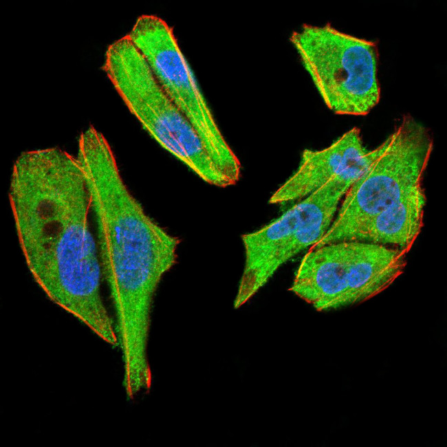 TBCC Antibody in Immunocytochemistry (ICC/IF)