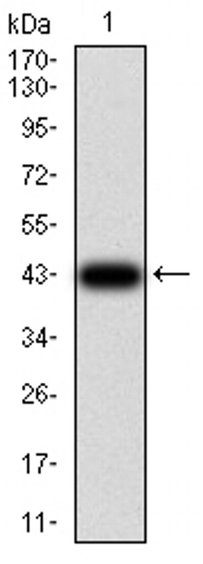 TCF4 Antibody in Western Blot (WB)