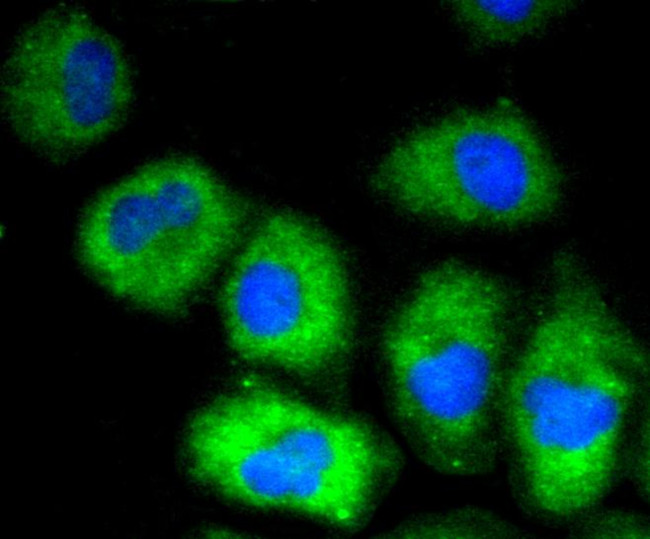 VCAM-1 (CD106) Antibody in Immunocytochemistry (ICC/IF)