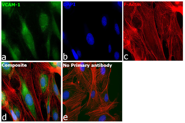 VCAM-1 (CD106) Antibody in Immunocytochemistry (ICC/IF)