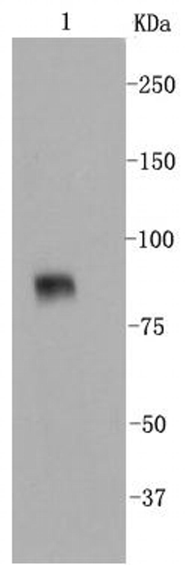 VCAM-1 (CD106) Antibody in Western Blot (WB)