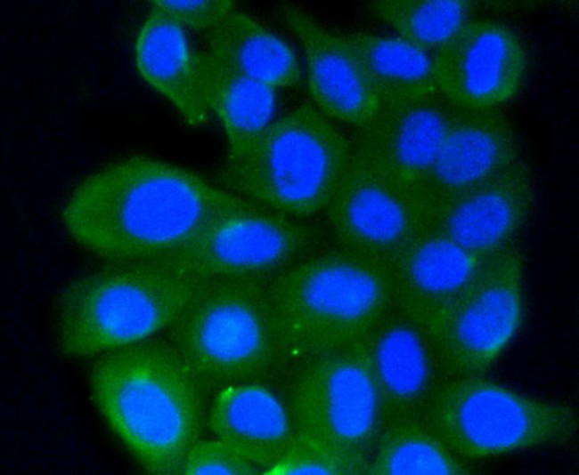 RhoA/RhoB/RhoC Antibody in Immunocytochemistry (ICC/IF)