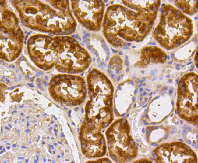 Caspase 2 Antibody in Immunohistochemistry (Paraffin) (IHC (P))