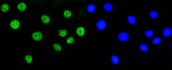 H2AK9ac Antibody in Immunocytochemistry (ICC/IF)