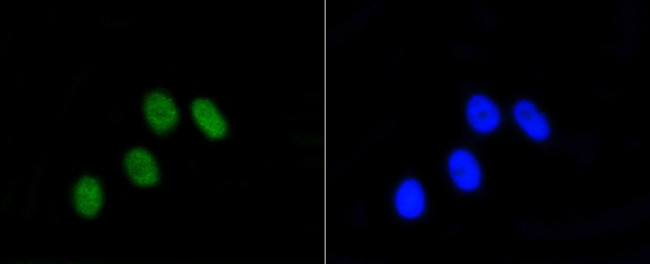 Phospho-Rb (Ser807) Antibody in Immunocytochemistry (ICC/IF)