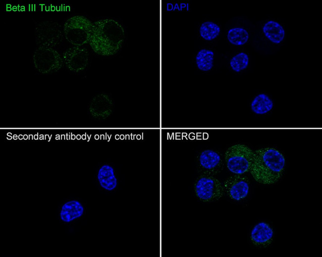 Beta III Tubulin Antibody in Immunocytochemistry (ICC/IF)