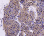 ATM Antibody in Immunohistochemistry (Paraffin) (IHC (P))
