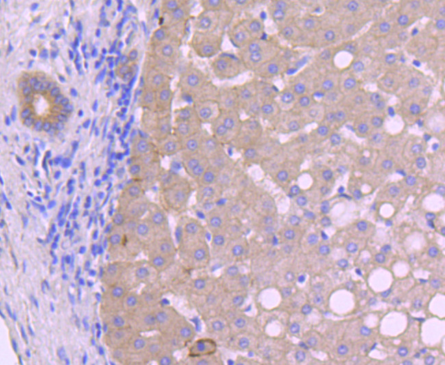 N-cadherin Antibody in Immunohistochemistry (Paraffin) (IHC (P))