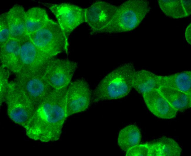 Cathepsin D Antibody in Immunocytochemistry (ICC/IF)