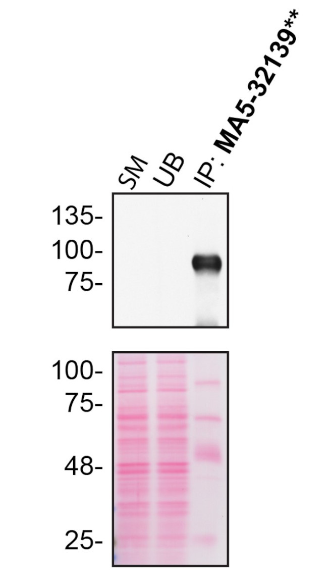 M-CSF Antibody in Immunoprecipitation (IP)