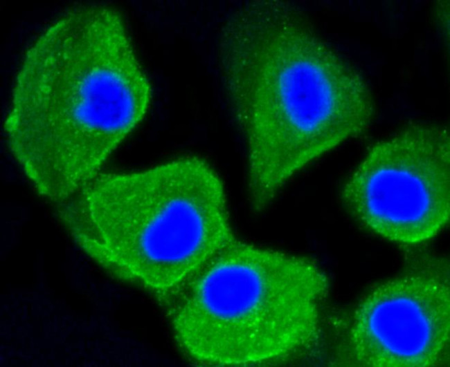 LC3A Antibody in Immunocytochemistry (ICC/IF)