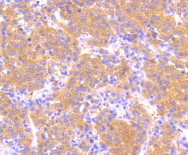 Phospho-MEK1 (Ser218, Ser222) Antibody in Immunohistochemistry (Paraffin) (IHC (P))