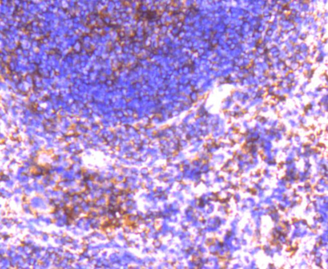 GRK2 Antibody in Immunohistochemistry (Paraffin) (IHC (P))