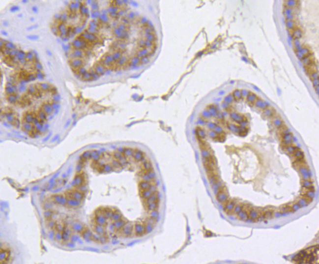 Catenin alpha-1 Antibody in Immunohistochemistry (Paraffin) (IHC (P))