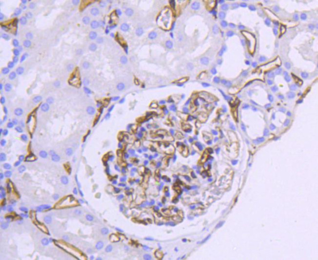 HLA-DR Antibody in Immunohistochemistry (Paraffin) (IHC (P))